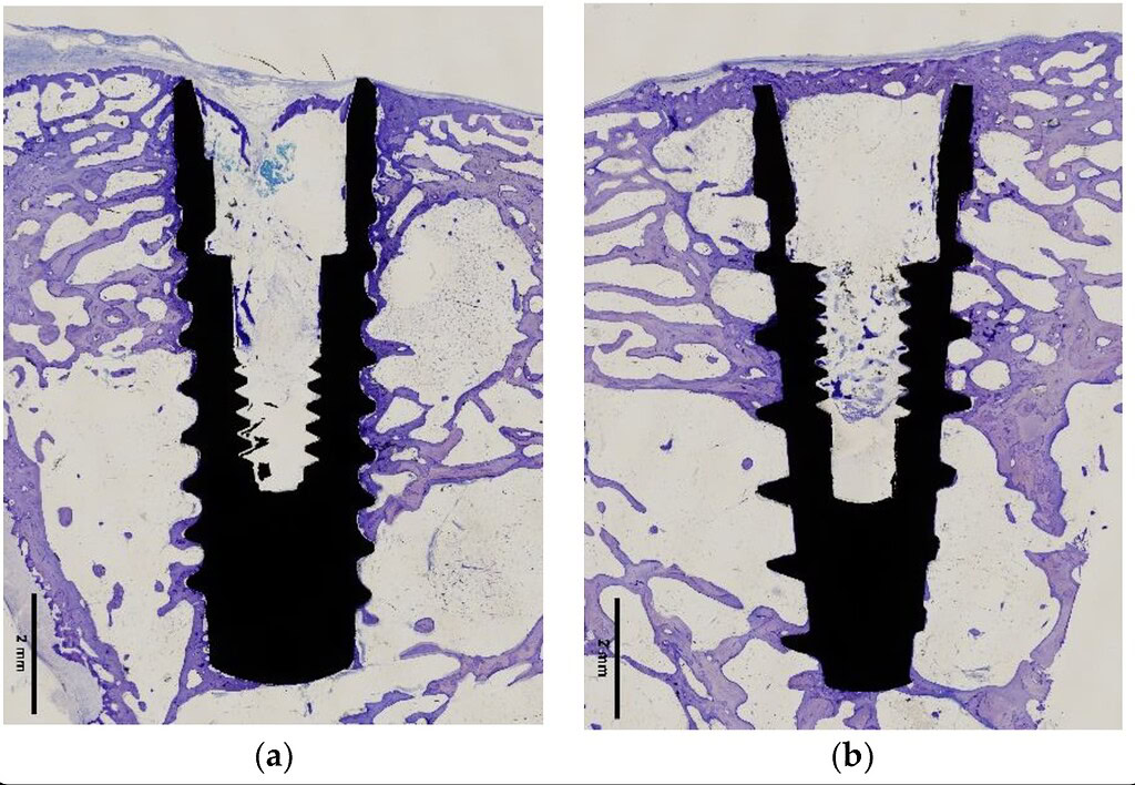 cut bone implant histological sections