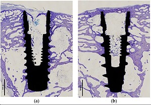 cut bone implant histological sections
