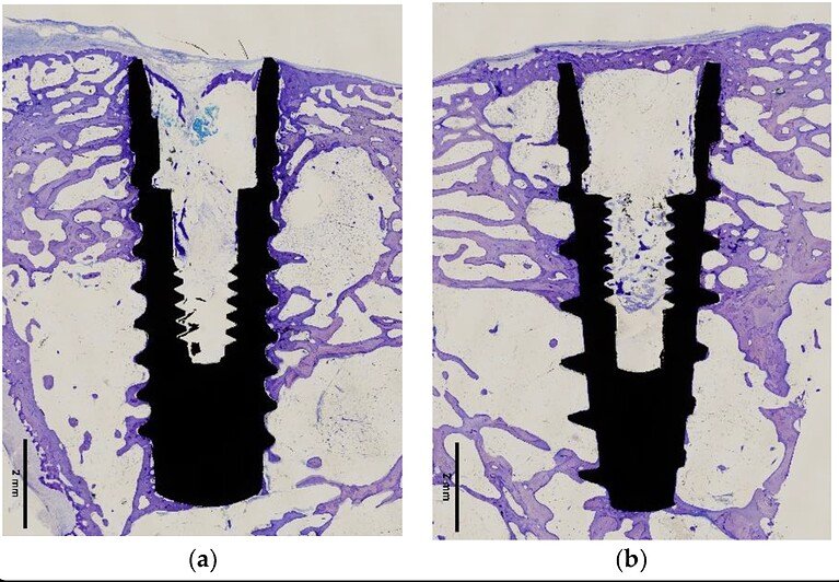 cut bone implant histological sections