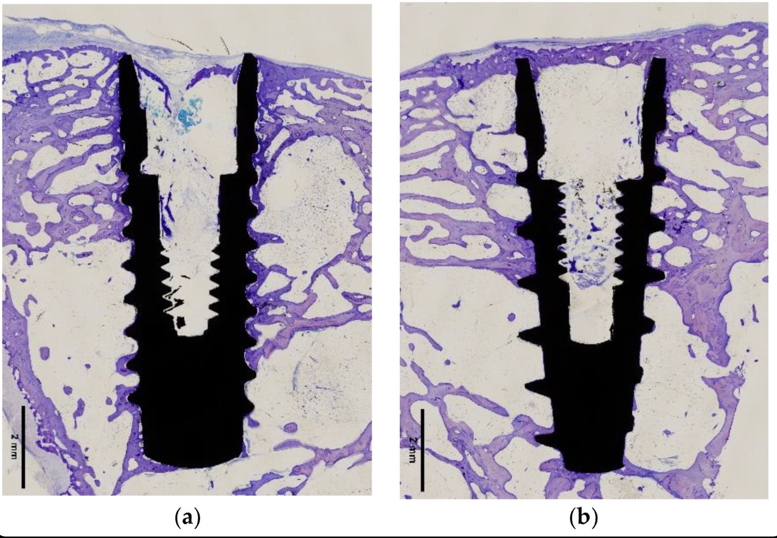 La cortadora de hilo de diamante sin fin es una máquina herramienta perfecta para el corte de precisión Cut Bone Implant Histological Sections Without Displacement: A Practical Guide